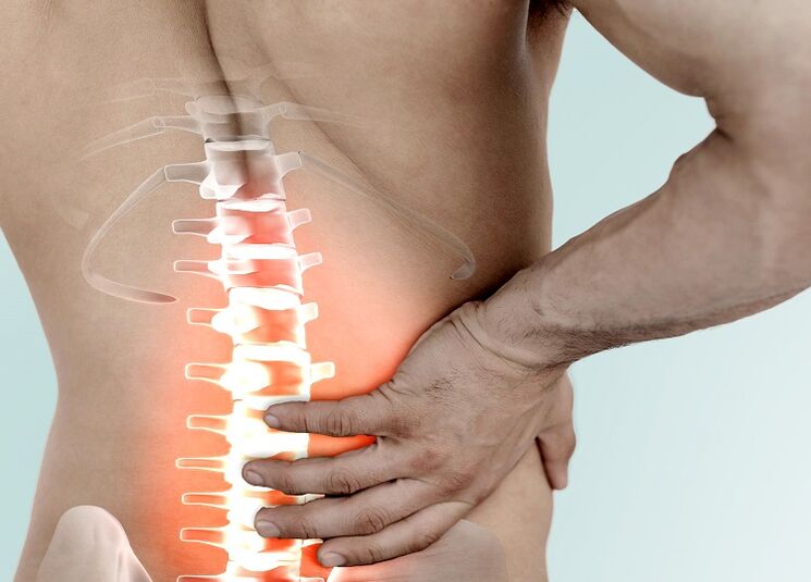 dolor de espalda en la región lumbar