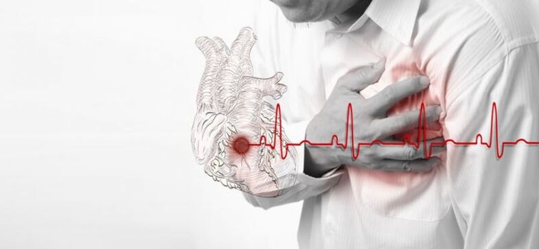 ataque al corazón como la causa del dolor debajo del omóplato izquierdo