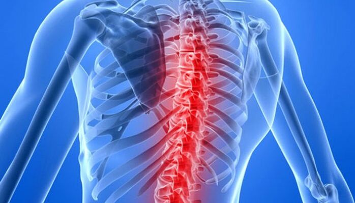 Las patologías de la columna son las causas más comunes de dolor de espalda en la zona del omóplato. 