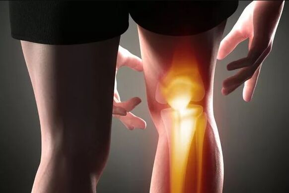 Artrosis de la articulación de la rodilla