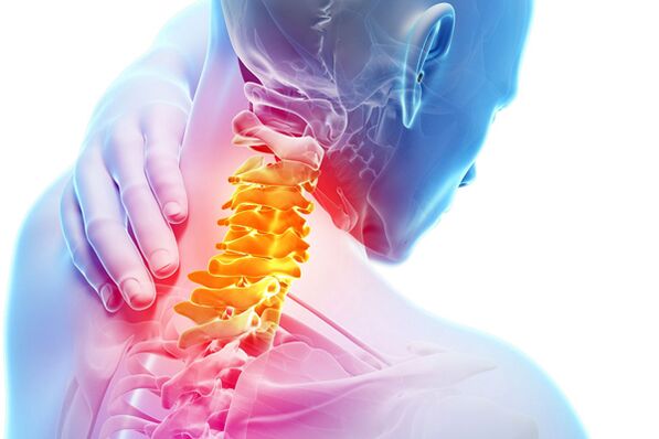 Osteocondrosis cervical