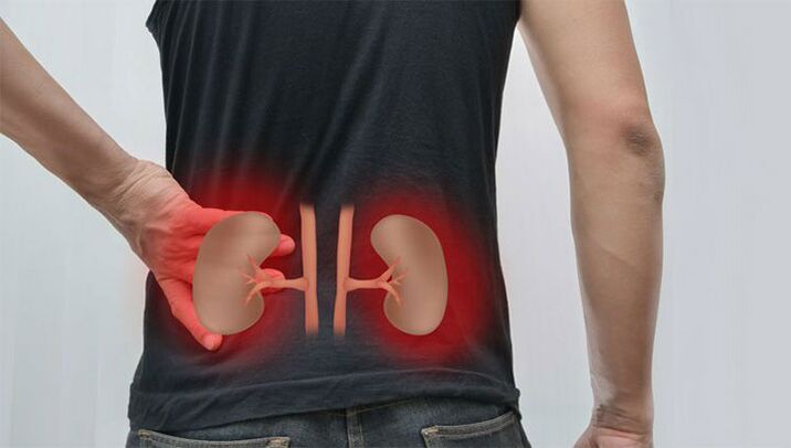 Dolor lumbar debido a una enfermedad renal.