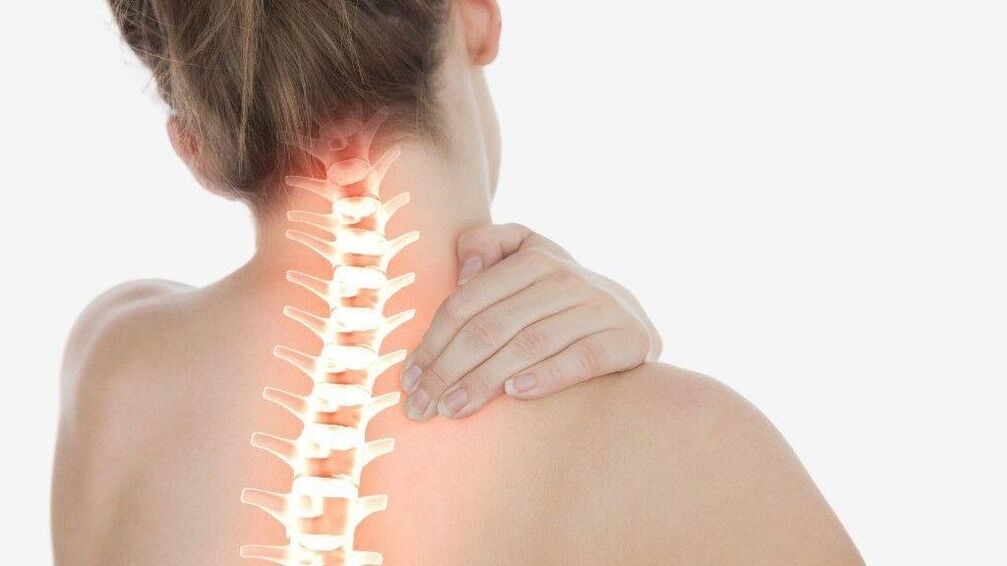 Con osteocondrosis de la columna cervical, se puede desarrollar síndrome radicular.