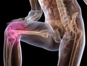 dolor en la rodilla con artrosis